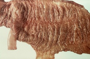 view Worms in horses: trichoneme nodules.