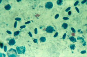view Psittacosis: chlamydia psittaci cell culture