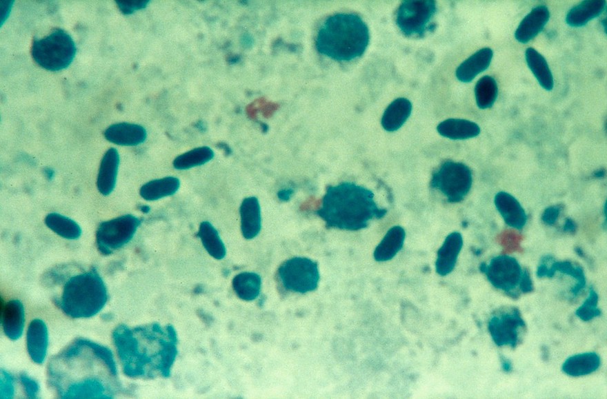Psittacosis: chlamydia psittaci cell culture
