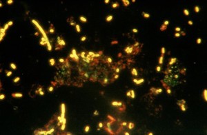 view Psittacosis: chlamydia psittaci cell culture