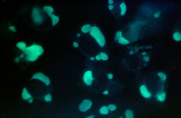 Psittacosis: chlamydia psittaci cell culture