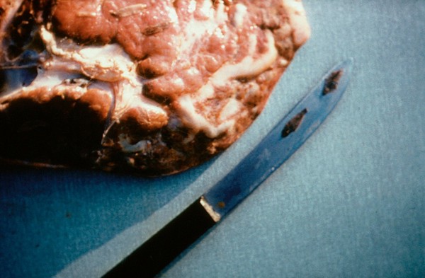 Liverfluke: fluke in bile ducts of liver