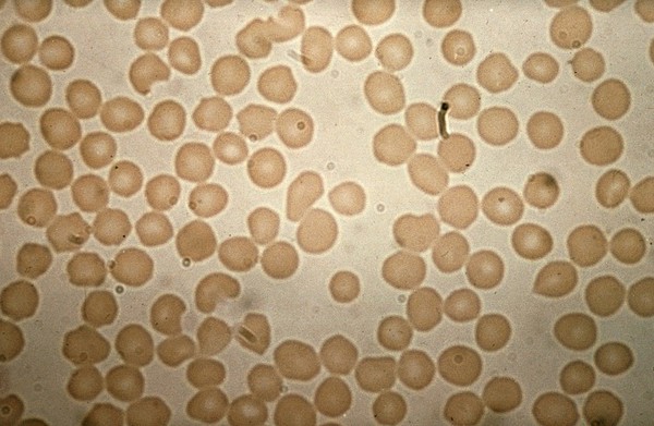 Normal sheep blood smear stained by giemsa.
