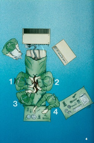 view Illustration: positioning of surgical team