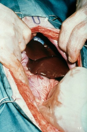 Opened up dog: exposing the liver