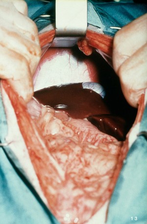 view Opened up dog: exposing the liver