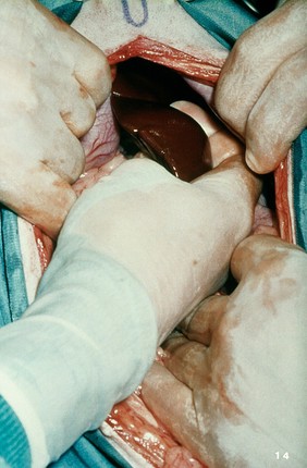 Opened up dog: palpating the liver