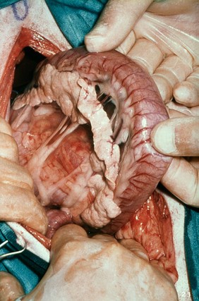 Opened up dog: duodenum and pancreas