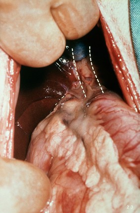 Opened up dog: Close-up: common bile duct