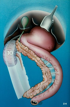 view Illustration: position of dog's right kidney