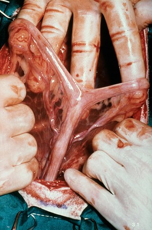 view Opened up dog: uterus, arteries, and veins