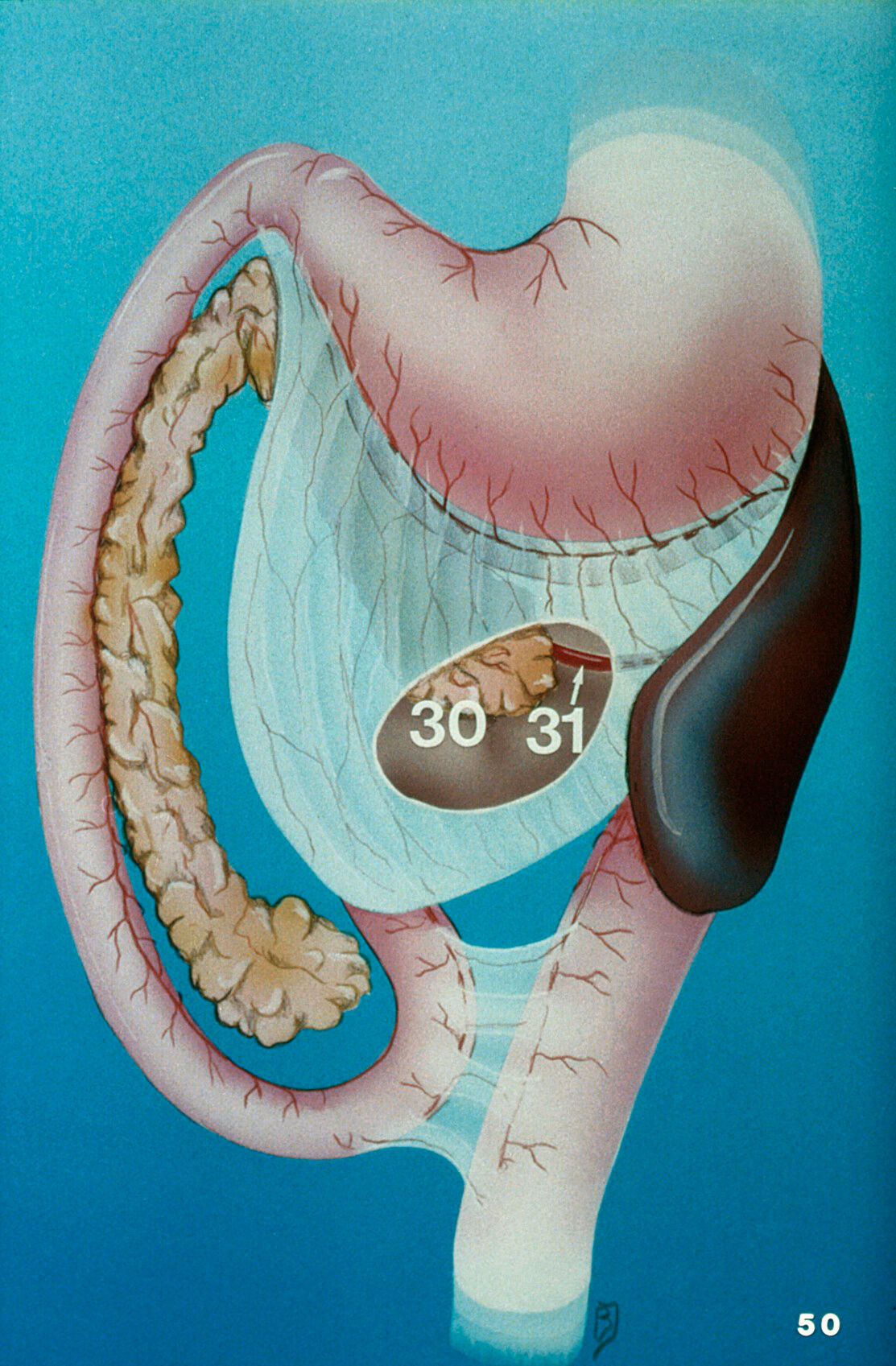 Illustration: dog's pancreas, splenic artery | Wellcome Collection