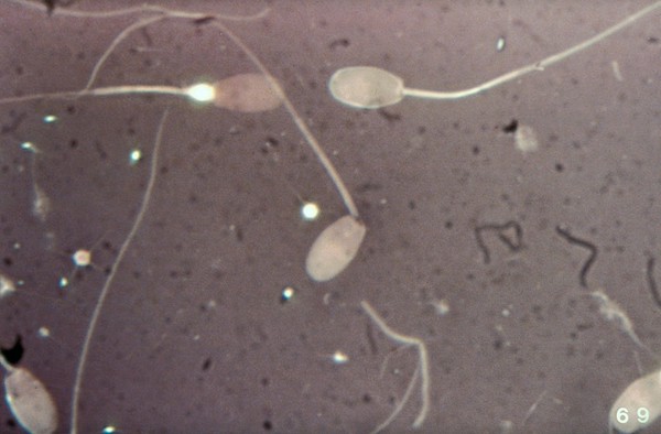 Microscopic examination of ram's semen smear