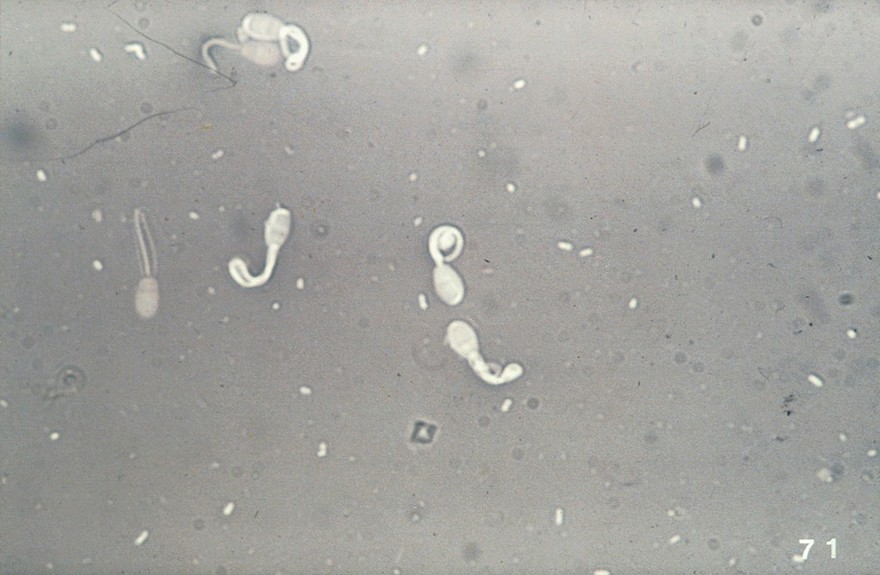 Microscopic examination of ram's semen smear