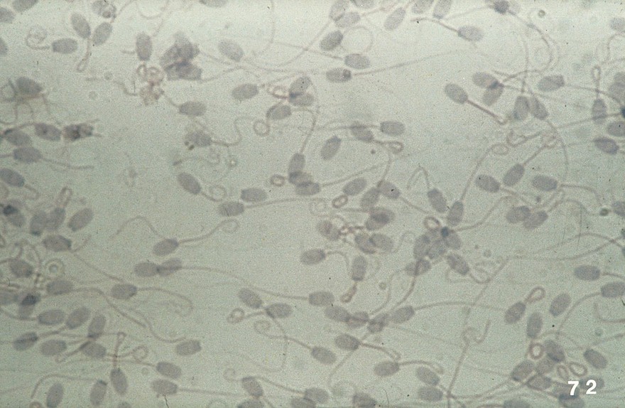 Microscopic examination of ram's semen smear