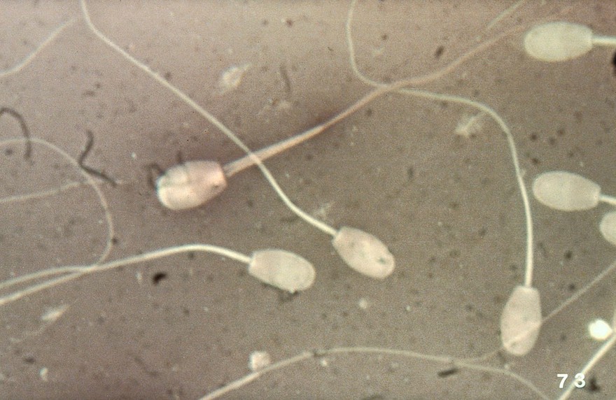 Microscopic examination of ram's semen smear