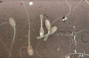 view Microscopic examination of ram's semen smear