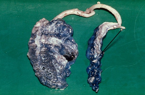 Postmortem of tortoise: severe pneumonia