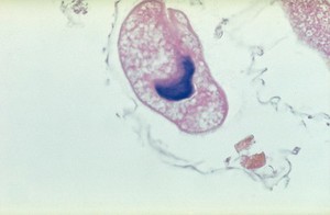 view Protozoan balantidium coli - magnified