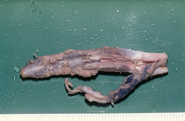 Lacerated, amputated penis of a tortoise.