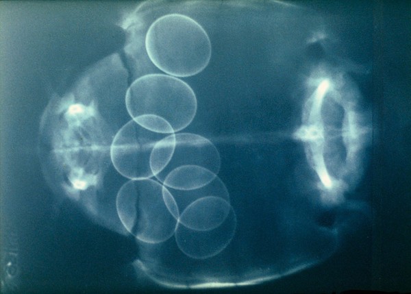 Radiograph of normal eggs in a tortoise.