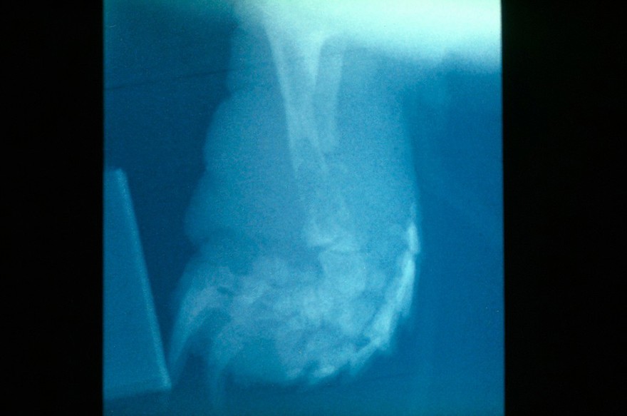 Tortoise: osteomyelitis of the tibia