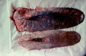 view Bovine spleens: normal & "slaughter spleen"