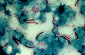 view Blood smear from bovine anthrax case, stained by