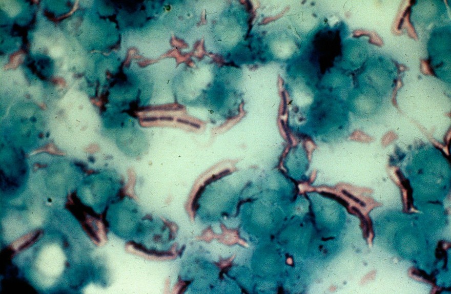 Blood smear from bovine anthrax case, stained by