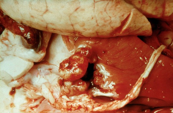 Chronic erysipelas in a pig: heart valves