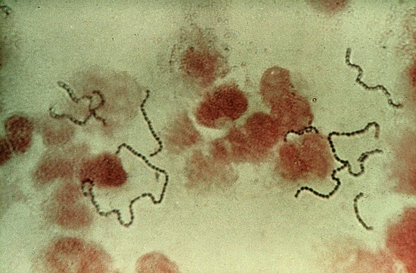 Erysipeloid in man - from meat handling