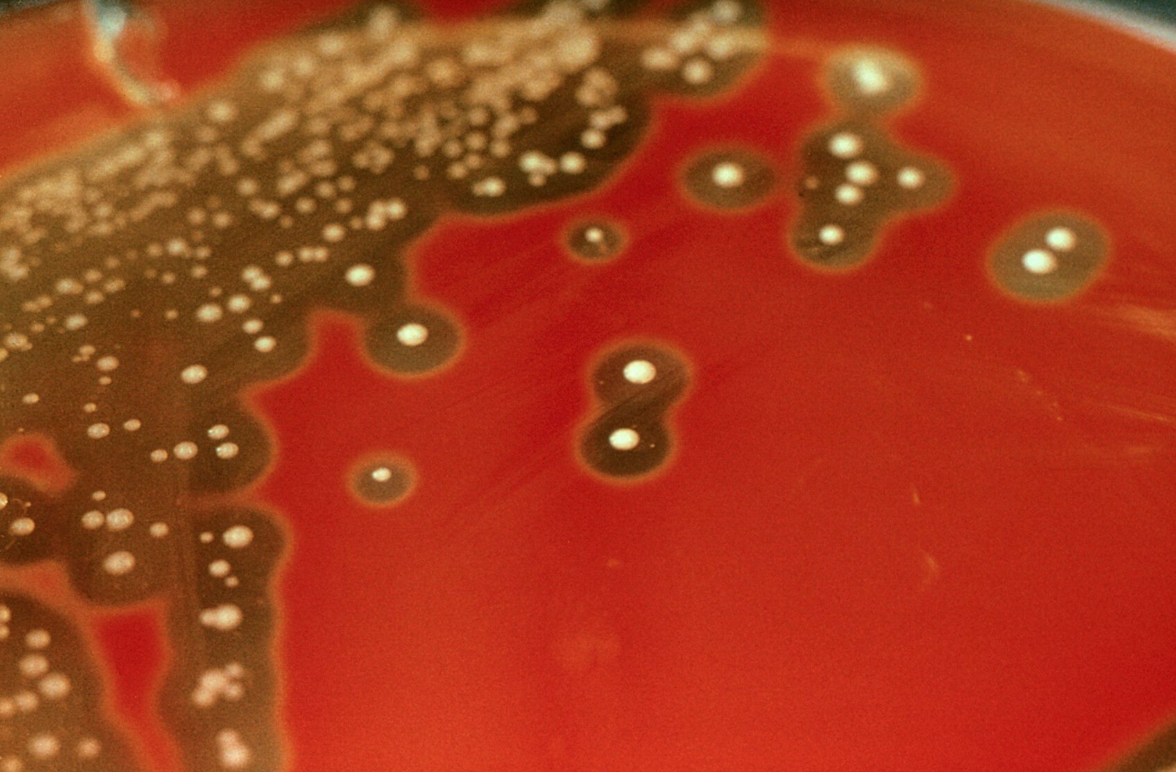 streptococcus-pyogenes-colonies-on-blood-agar-streptococcus-pyogenes