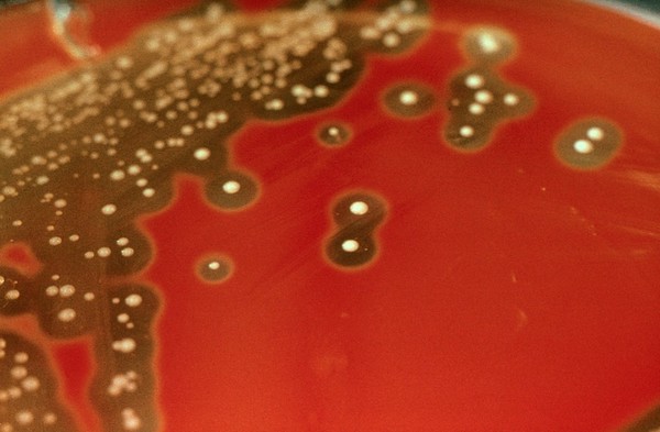 Streptococcus pyogenes: colonies growing on blood