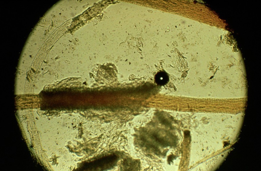 Meat handling: epithelial cells