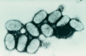 view Orf virus under electron microscope