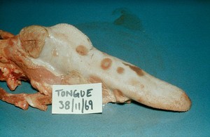 view Bovine papular stomatikis lesion on tongue