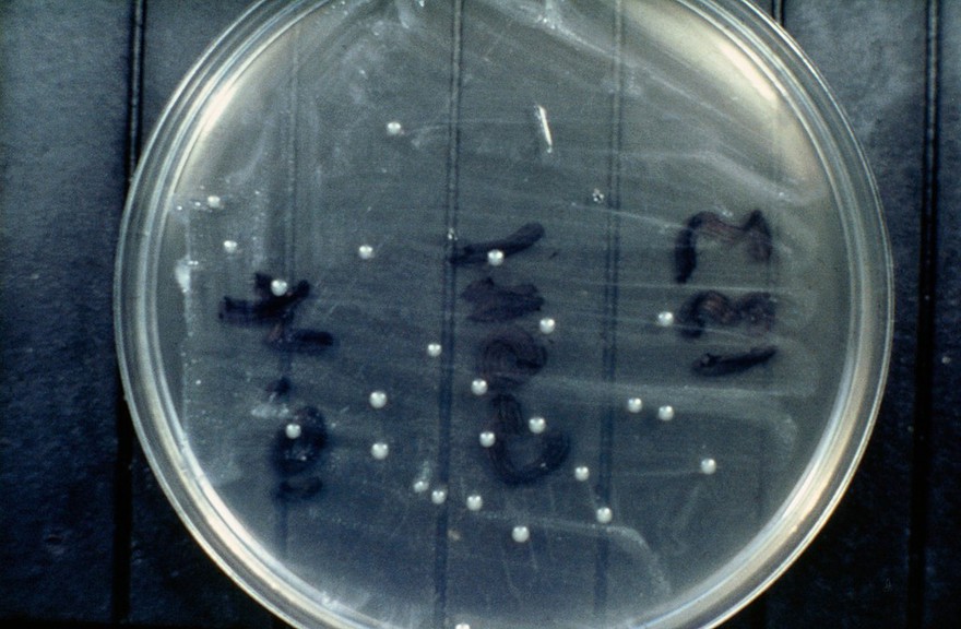 Brucella colonies growing on serum dextrose