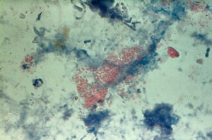 view Placental smear from a cow, stained by modified