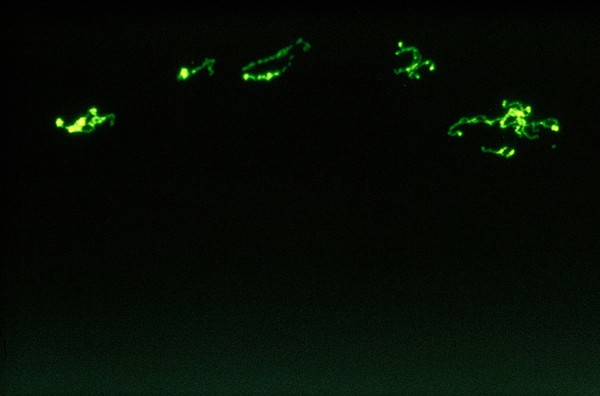 Leptospira organisms: microscopic view