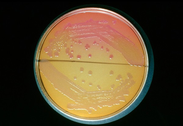 Salmonella colonies - MacConkey's Medium