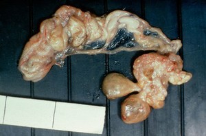 view Salmonella pullorum: ova in chicken