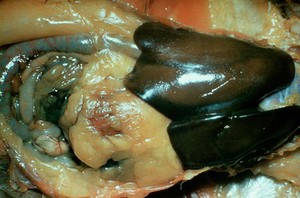 view Salmonella gallinarum: liver of chicken