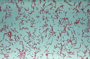 view Campylobacter organisms, stained by Gram's method