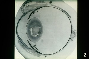 view Saggital section of a canine eye.