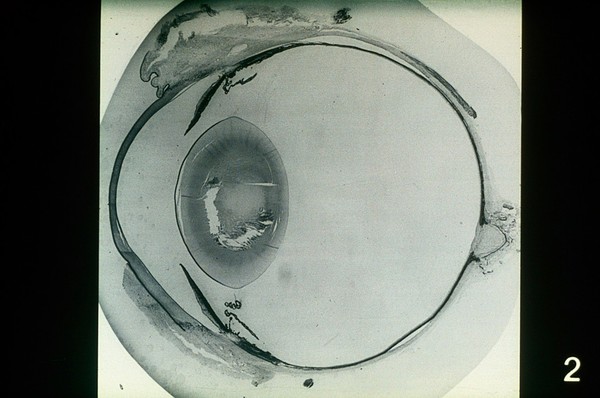 Saggital section of a canine eye.