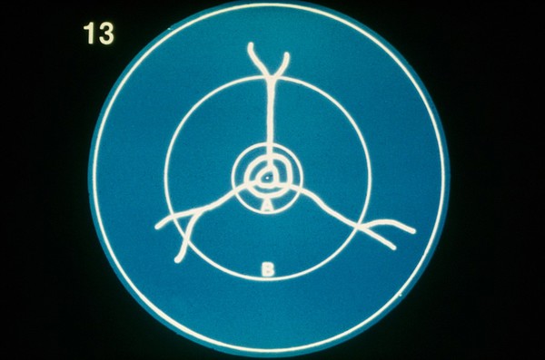 Areas of canine fundus - opthalmoscope view