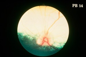 view Canine eye: normal fundus from Labrador