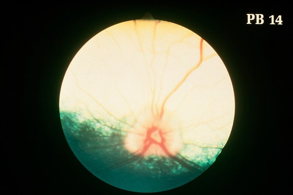 Canine eye: normal fundus from Labrador