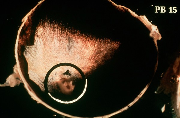Posterior segment of the canine eye