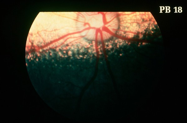 Canine eye: the non-tapetal fundus